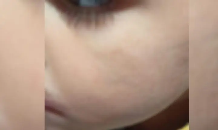 Prefeitura de Tatuí investiga professora após mãe denunciar agressão contra filho de 3 anos